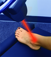 MLS Foot Laser Therapy